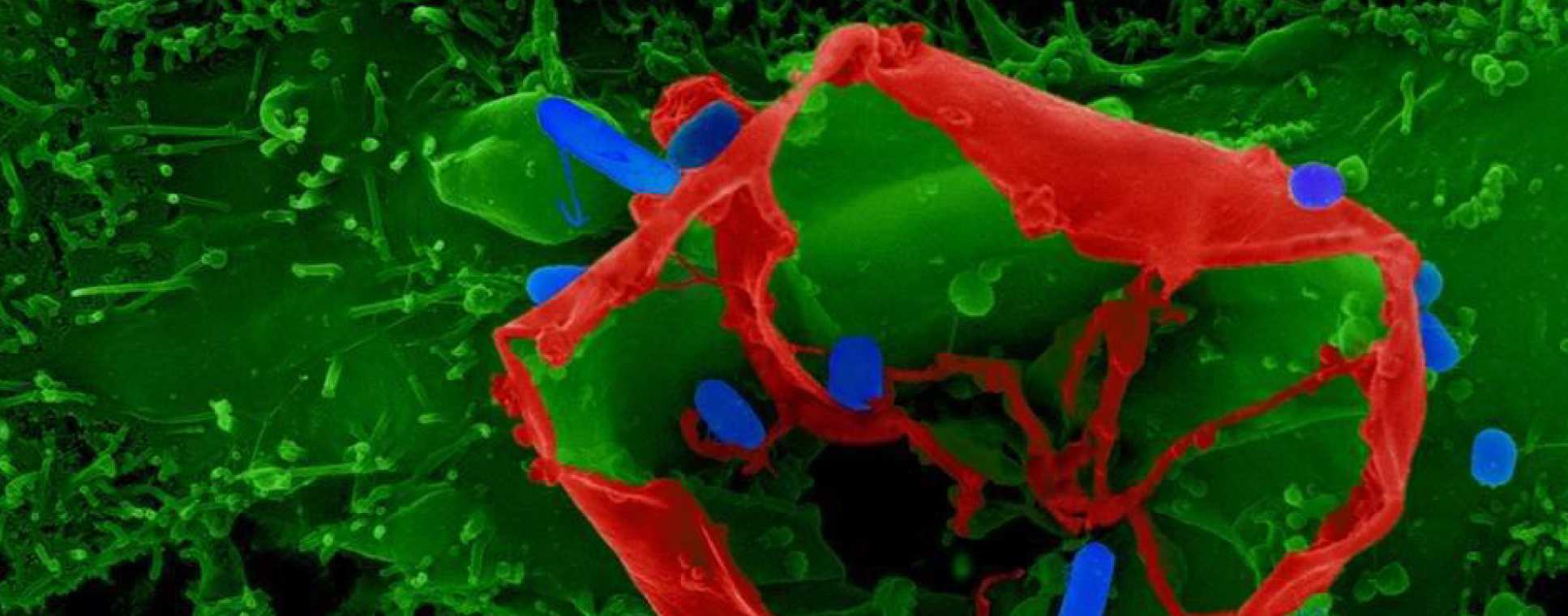 Cell enclosing bacteria